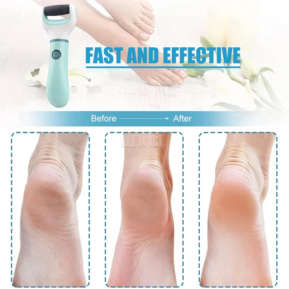 Electric Foot Grinder Remover Dead Skin Professional Grinding Exfoliator Remove Dry Dead Cracked Safe Painless Repair Care